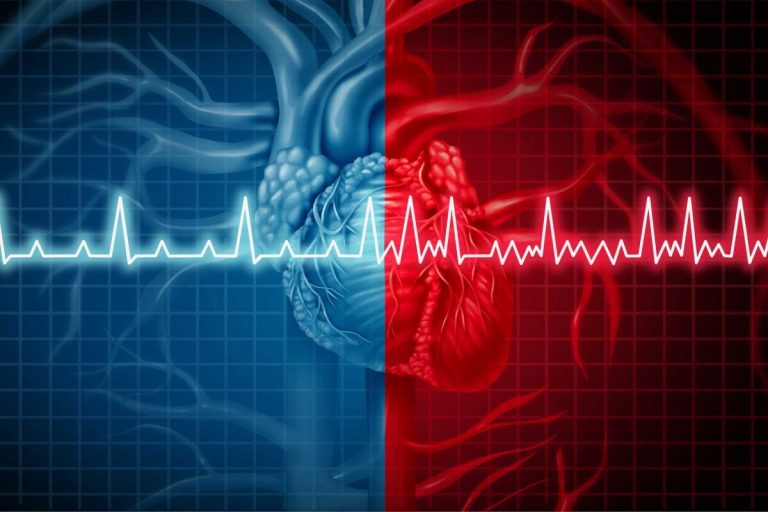 AI-based method predicts risk of atrial fibrillation