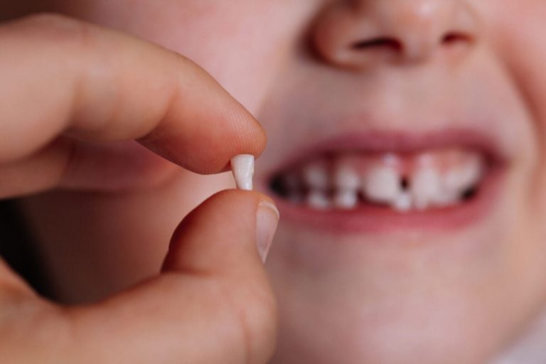 Baby teeth may help identify kids at risk for mental disorders